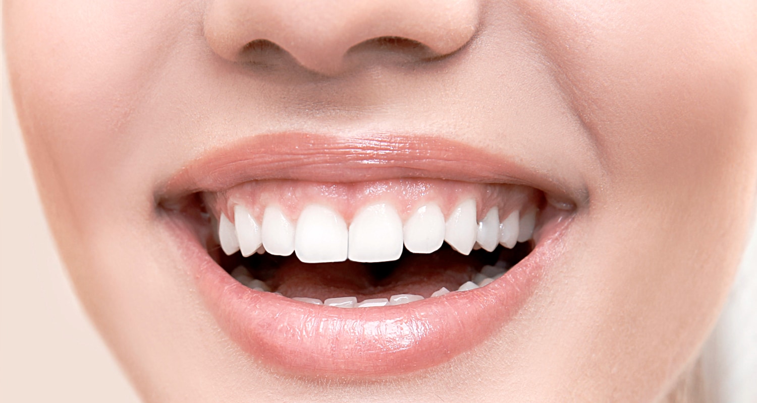 Gülerken Diş Eti Görünmesi - Dr. Şerafettin Saraçoğlu | Nişantaşı Dermatolog
